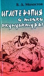 Иглотерапия и точки акупунктуры