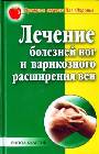 Лечение болезней ног и варикозного расширения вен